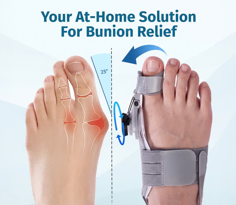 Treatmedy Bunion Fix alignment illustration